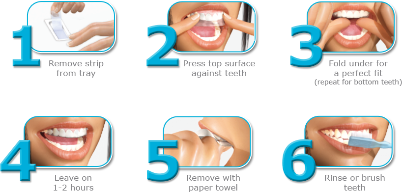 Lumist Advanced Teeth Whitening Strips